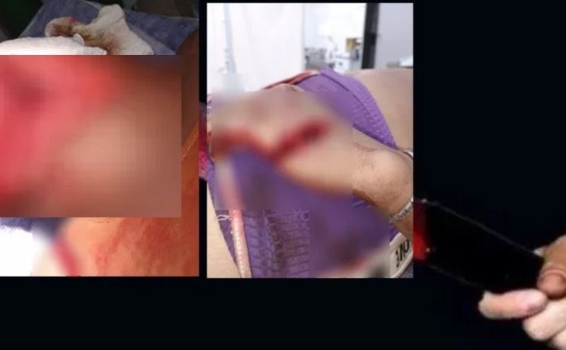 Mulher é golpeada com facão, amarrada e torturada pelo marido em Rondônia